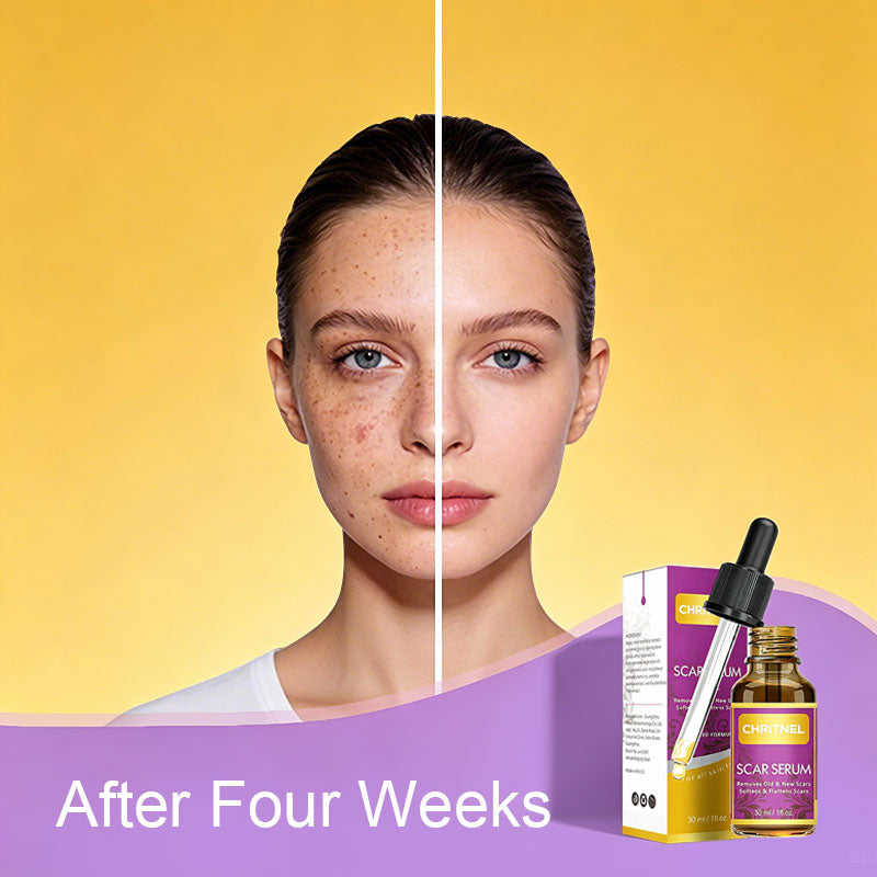 OEM ODM SCAR SERUM 
