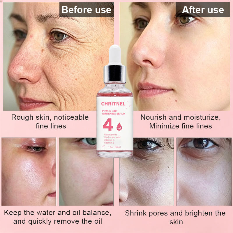 https://www.guangzhouyixuan.com/products/oem-odm-4-in-1-power-serum?variant=47885739426018