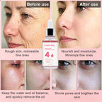 https://www.guangzhouyixuan.com/products/oem-odm-4-in-1-power-serum?variant=47885739426018