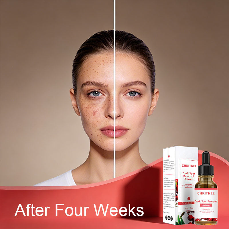 OEM ODM Dark Spot Removal Serum